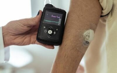 Decisão determina cobertura da bomba de insulina pelo plano de saúde